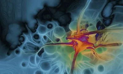 Fucoidan - một chất tổng hợp chống ung thư